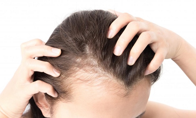 Presenting the Top 5 Hair Loss Products